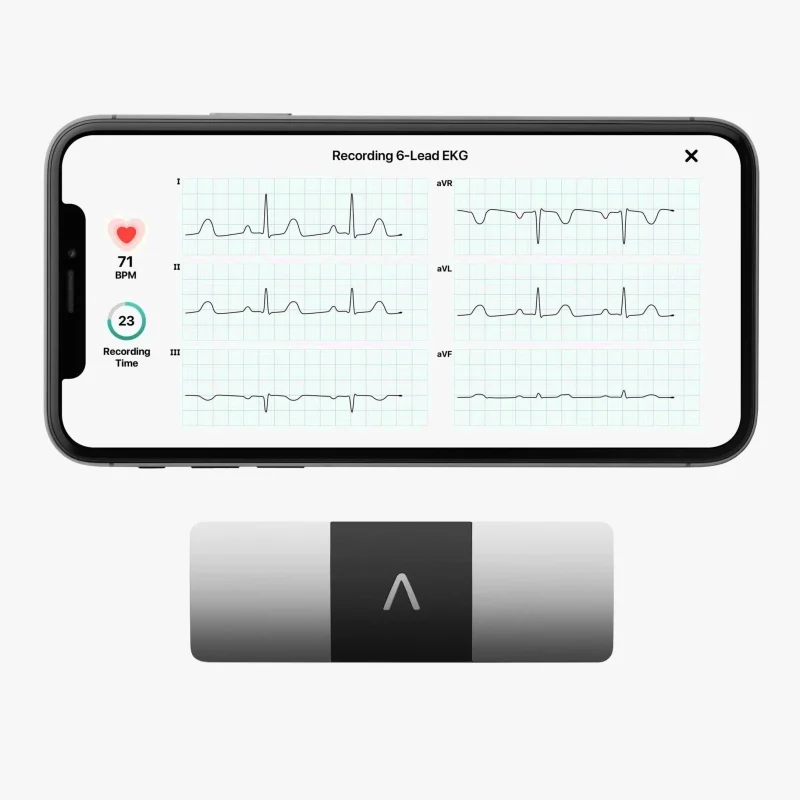 AliveCor KardiaMobile 6L Personal EKG Monitor, Black - KM-6L-E