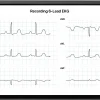 AliveCor KardiaMobile 6L Personal EKG Monitor, Black - KM-6L-E